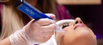 SkinPen stimuleert collageen en verbetert de huidstructuur zichtbaar.